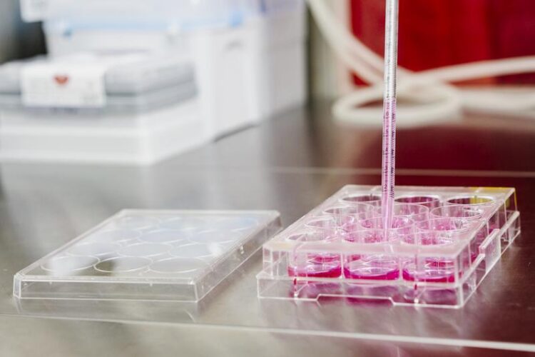 Neue-Standards-zur-Quantifizierung-des-Hepatitis-B-Virus-Reservoirs-in-Leberzellen