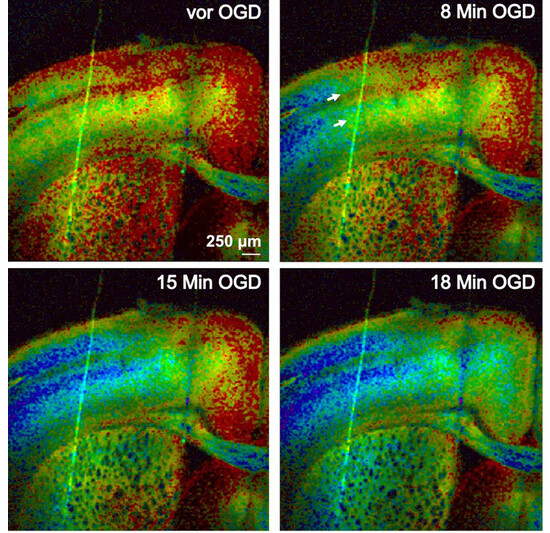 Dargestellt sind farbkodierte Signale des ATP-Sensors‚ den die Nervenzellen der Mäuse exprimieren. Die Bilder zeigen in zeitlicher Folge den ATP-Abfall im Zuge einer Depolarisationswelle ausgelöst durch Sauerstoff- (O2) und Glukose-Deprivation (OGD).